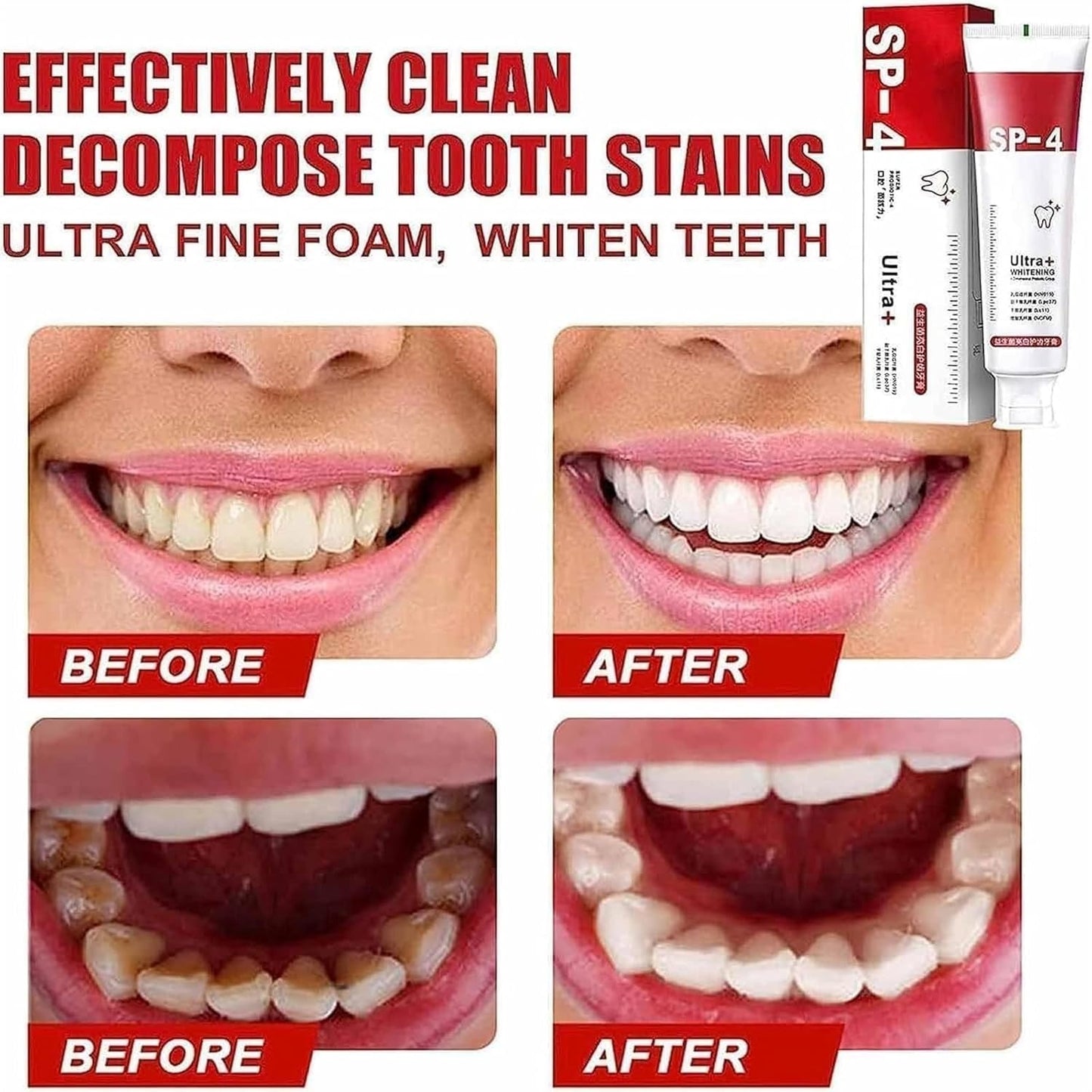 Yayashi Sp-4 Ultra Whitening Toothpaste Probiotic Stain Remover 100ml